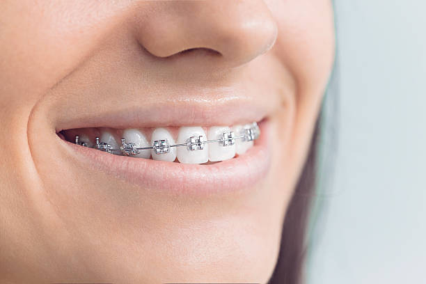 Best Invisalign and Clear Aligners  in Biola, CA